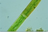 Closterium intermedium