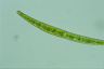 Closterium intermedium