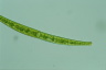 Closterium intermedium