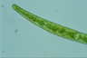 Closterium intermedium