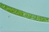 Closterium intermedium