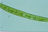 Closterium intermedium