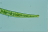 Closterium intermedium