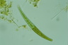 Closterium intermedium