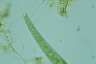 Closterium intermedium