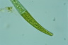 Closterium intermedium