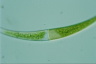 Closterium rostratum