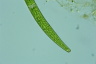 Closterium intermedium