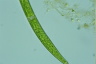 Closterium intermedium