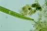 Closterium intermedium