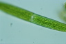 Closterium intermedium