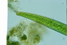 Closterium intermedium