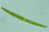 Closterium intermedium