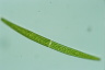 Closterium intermedium