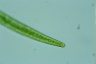 Closterium intermedium