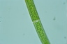 Closterium intermedium