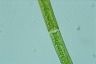 Closterium intermedium