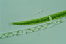 Closterium intermedium