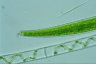 Closterium intermedium