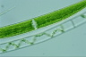 Closterium intermedium