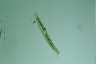 Closterium intermedium