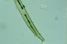 Closterium intermedium