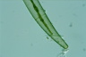 Closterium intermedium