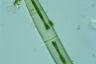 Closterium intermedium