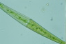 Closterium kuetzingii