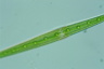 Closterium kuetzingii