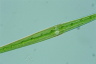 Closterium kuetzingii