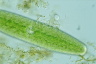 Netrium digitus