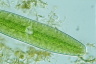 Netrium digitus