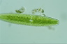 Netrium digitus