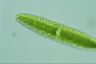 Netrium digitus