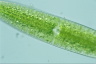 Netrium digitus