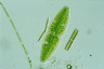 Netrium digitus