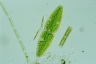 Netrium digitus