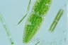 Netrium digitus