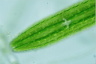 Netrium digitus