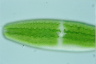 Netrium digitus