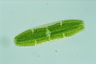 Netrium digitus