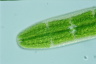 Netrium digitus