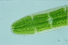 Netrium digitus