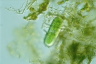 Cylindrocystis