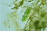 Cylindrocystis