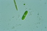 Cylindrocystis