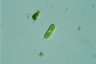 Cylindrocystis