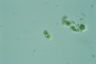 Cylindrocystis