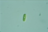 Cylindrocystis